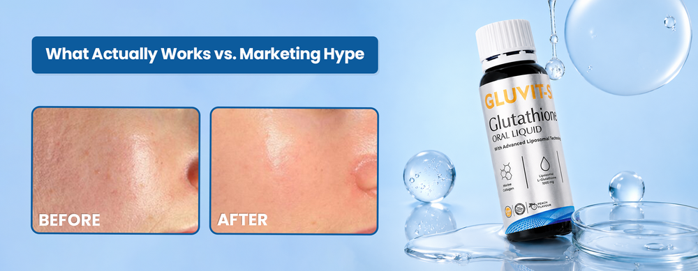 hydroquinone vs glutathione as a skinlightening agent and in melasma: a systematic review - Sarkar - 2025 - International Journal of Dermatology L-Glutathione Vs Glutathione Skin Whitening: