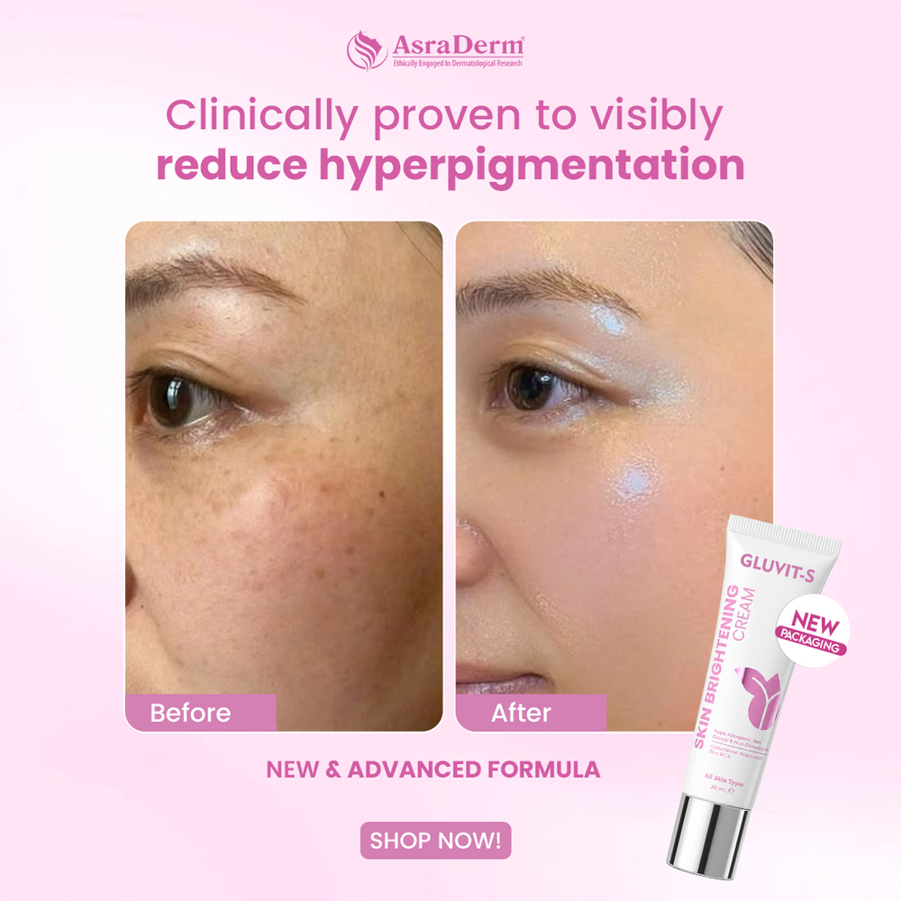 Gluvit-s Glutathione Skin Brightening Cream